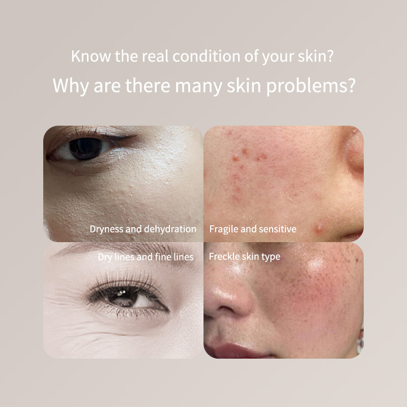 Skincare Only You - Bolígrafo probador de piel portátil, solo