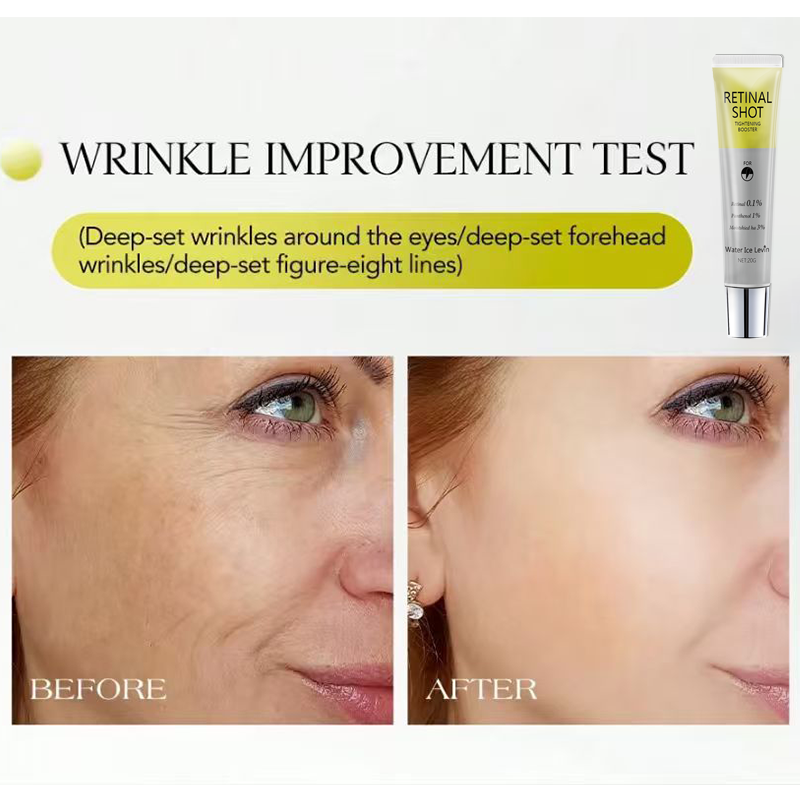 Retinal 0.1% Intensive Shot, P - Caffeine Eye Serum reseña y precio