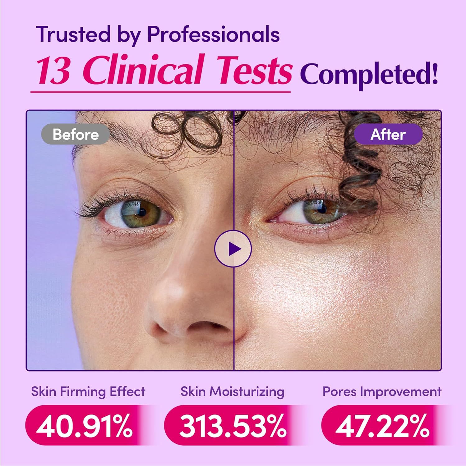 Suero de Bakuchiol y Vitamina  - Bakuchiol Retinol Alternative reseña y precio